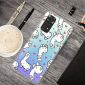 Coque Xiaomi Redmi Note 11 / 11S Alpaga